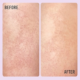 KP Bump Eraser Body Scrub with 10% AHA - Körper-Peeling mit AHAs